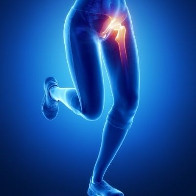 Hip and Groin Pain: Causes and treatmet options, Chiropractic and Physiotherapy, The House Clinics, Bristol