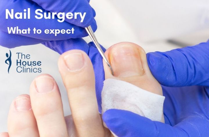 Toenail Surgery: A Complete Guide For Patients image
