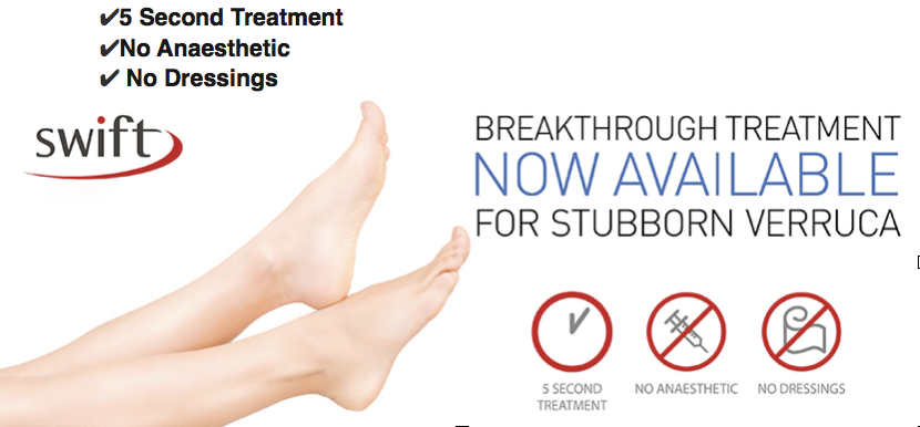 Swift Treatment - Breakthrough Treatment Now Available For Stubborn Verruca | The House Clinics